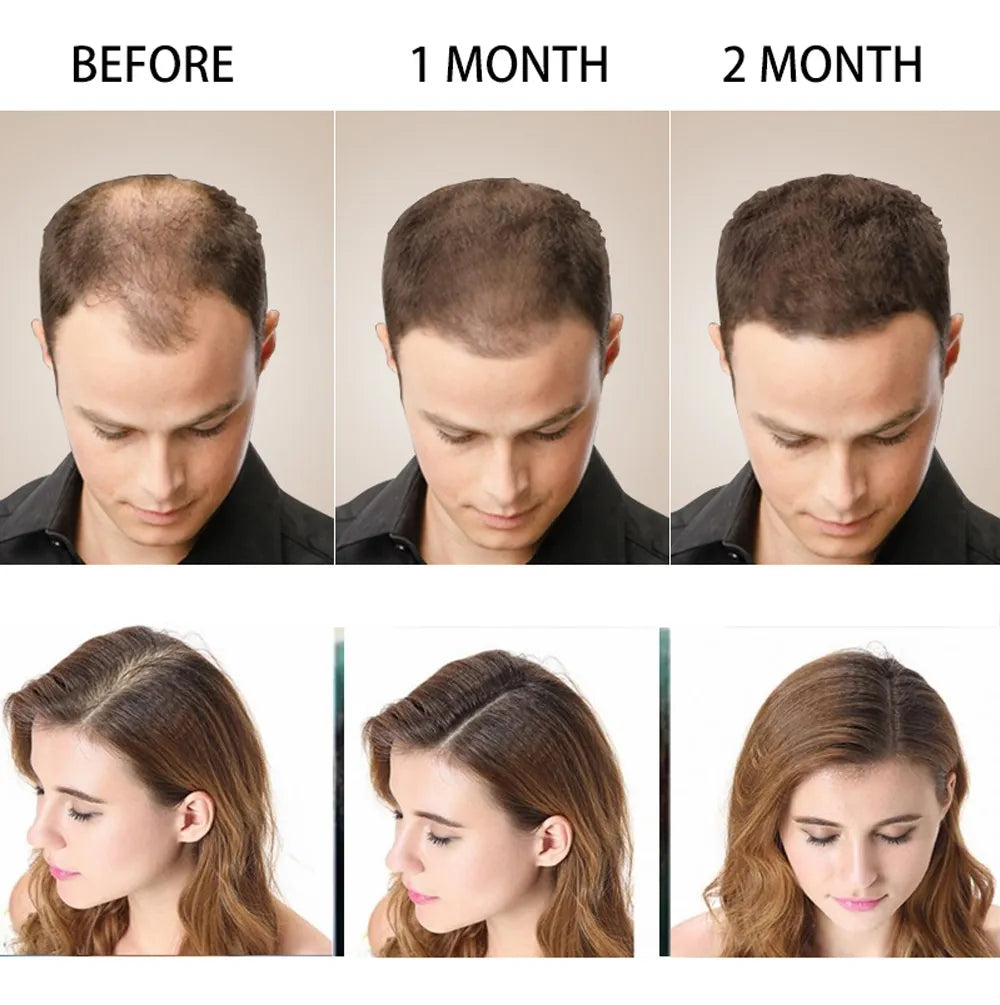 Shampoo Anticaida Hair Care Disaar 200 M