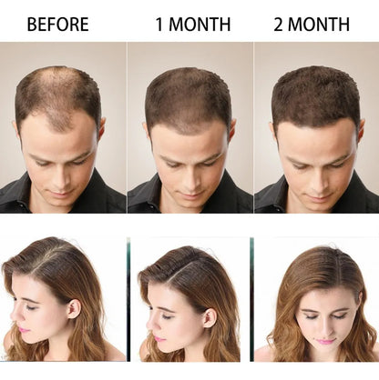 Shampoo Anticaida Hair Care Disaar 200 M